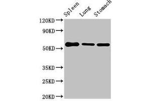 Western Blot Positive WB detected in: Mouse spleen tissue, Mouse lung tissue, Mouse stomach tissue All lanes: Glp1r antibody at 3 μg/mL Secondary Goat polyclonal to rabbit IgG at 1/50000 dilution Predicted band size: 54 kDa Observed band size: 54 kDa (GLP1R Antikörper  (AA 22-145))