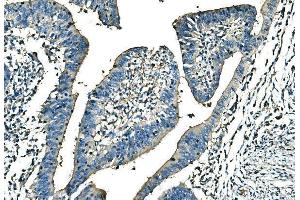 IHC analysis of Ankyrin Erythroid/ANK/ANK1 using anti-Ankyrin Erythroid/ANK/ANK1 antibody (ABIN7599959). (Erythrocyte Ankyrin Antikörper  (AA 1300-1844))