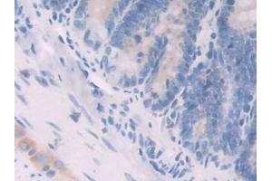 IHC-P analysis of Rat Small intestine Tissue, with DAB staining. (Neuregulin 1 Antikörper  (AA 328-486))