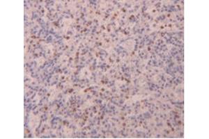 IHC-P analysis of Human Spleen Tissue, with DAB staining. (FLG2 Antikörper  (AA 1222-1368))