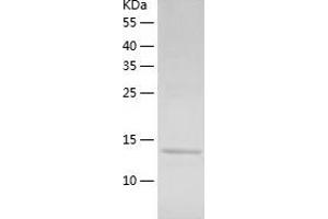 Western Blotting (WB) image for BUD31 Homolog (BUD31) (AA 1-144) protein (His tag) (ABIN7122056)