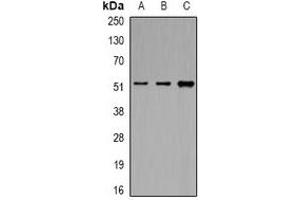 Western blot analysis of eIF3E expression in MCF7 (A), K562 (B), HepG2 (C) whole cell lysates. (EIF3E Antikörper)