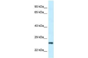 Western Blot showing RPS9 antibody used at a concentration of 1 ug/ml against Hela Cell Lysate (RPS9 Antikörper  (N-Term))