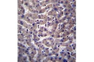 Immunohistochemistry (Paraffin-embedded Sections) (IHC (p)) image for anti-Prostaglandin Reductase 2 (PTGR2) (AA 72-102), (N-Term) antibody (ABIN955621)