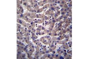 Formalin fixed and paraffin embedded human liver tissue reacted with ZADH1 Antibody (N-term) followed by peroxidase conjugation of the secondary antibody and DAB staining