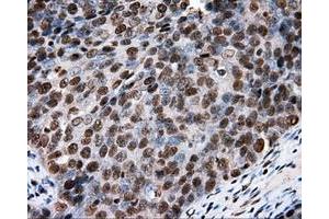 Immunohistochemical staining of paraffin-embedded colon tissue using anti-RC204952 mouse monoclonal antibody. (XRCC1 Antikörper)