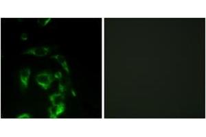Immunofluorescence analysis of HeLa cells, using eIF4G (Ab-1108) Antibody.