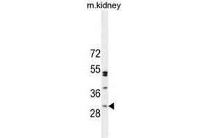 CF062 Antibody (Center) western blot analysis in mouse kidney tissue lysates (35µg/lane). (C6ORF62 Antikörper  (Middle Region))