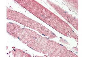 Anti-THNSL2 antibody IHC staining of human skeletal muscle. (THNSL2 Antikörper  (AA 192-204))