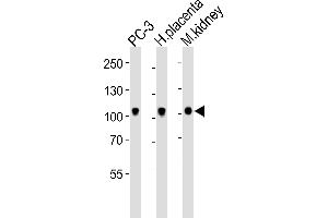 Western blot analysis of lysates from PC-3 cell line, human placenta, mouse kidney tissue lysate (from left to right), using Ephb4 Antibody (C-term) (ABIN6243858 and ABIN6577663). (EPH Receptor B4 Antikörper  (C-Term))