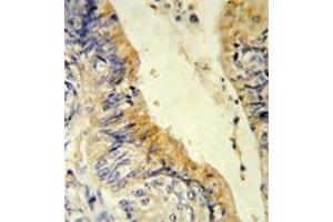 Image no. 2 for anti-Medium-Chain Specific Acyl-CoA Dehydrogenase, Mitochondrial (AA 196-225) antibody (ABIN452704) (Medium-Chain Specific Acyl-CoA Dehydrogenase, Mitochondrial (AA 196-225) Antikörper)