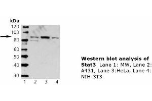Image no. 1 for anti-Signal Transducer and Activator of Transcription 3 (Acute-Phase Response Factor) (STAT3) antibody (ABIN331480) (STAT3 Antikörper)