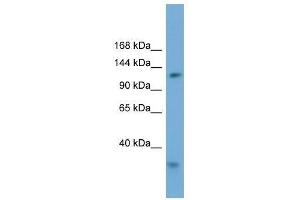 Western Blot showing RFC1 antibody used at a concentration of 1-2 ug/ml to detect its target protein. (RFC1 Antikörper  (Middle Region))