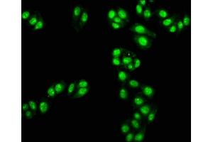 Immunofluorescence staining of HepG2 cells with ABIN7171330 at 1:100, counter-stained with DAPI. (TAL1 Antikörper  (AA 1-114))