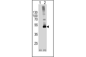 Western blot analysis of SPHK1-M1 Antibody (arrow) using rabbit polyclonal SPHK1-M1 Antibody (ABIN391345 and ABIN2841366).