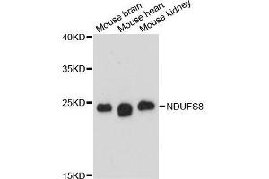 Western blot analysis of extracts of various cell lines, using NDUFS8 antibody. (NDUFS8 Antikörper  (AA 35-210))