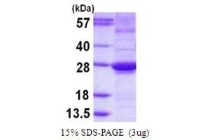SDS-PAGE (SDS) image for ADP-Ribosylation Factor-Like 15 (ARL15) (AA 1-204) protein (His tag) (ABIN667965)