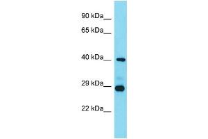 Host: Rabbit  Target Name: Lhfpl3  Sample Tissue: Mouse Heart lysates  Antibody Dilution: 1. (LHFPL3 Antikörper  (C-Term))