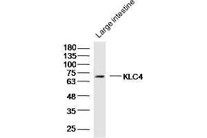 Mouse large intestine lysates probed with KLC4 Polyclonal Antibody, Unconjugated  at 1:300 dilution and 4˚C overnight incubation. (KLC4 Antikörper  (AA 51-150))