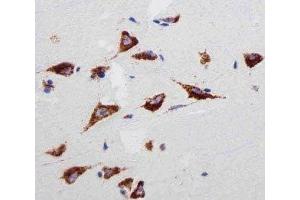 Immunohistochemistry (IHC) image for anti-Ribosomal Protein S6 (RPS6) antibody (ABIN3028983)