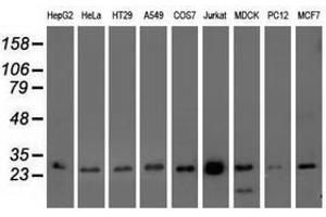Image no. 3 for anti-OTU Domain, Ubiquitin Aldehyde Binding 2 (OTUB2) antibody (ABIN1499938)