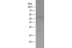 Western Blotting (WB) image for Protein Inhibitor of Activated STAT, 4 (PIAS4) (AA 334-510) protein (His-IF2DI Tag) (ABIN7124650) (PIAS4 Protein (AA 334-510) (His-IF2DI Tag))