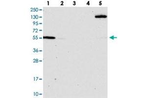 Western blot analysis of Lane 1: RT-4, Lane 2: U-251 MG, Lane 3: Human Plasma, Lane 4: Liver, Lane 5: Tonsil with OSBPL2 polyclonal antibody  at 1:100-1:250 dilution. (OSBPL2 Antikörper)