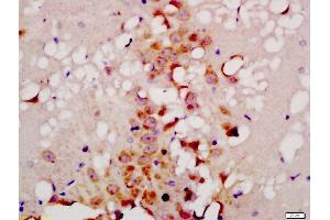 Formalin-fixed and paraffin embedded rat brain labeled with Anti-TG9B Polyclonal Antibody, Unconjugated  at 1:200 followed by conjugation to the secondary antibody and DAB staining