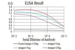 Black line: Control Antigen (100 ng),Purple line: Antigen (10 ng), Blue line: Antigen (50 ng), Red line:Antigen (100 ng) (BRD2 Antikörper  (AA 227-364))