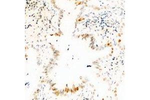 Immunohistochemical analysis of USP36 staining in human kidney formalin fixed paraffin embedded tissue section.
