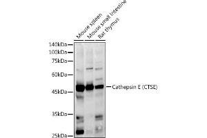 Western blot analysis of extracts of various cell lines, using Cathepsin E (CTSE) antibody (ABIN3016440, ABIN3016441, ABIN3016442 and ABIN6219747) at 1:1000 dilution. (Cathepsin E Antikörper)