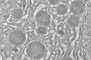 Immunoelectron Microscopy (IEM) image for anti-Heat Shock 60kDa Protein 1 (Chaperonin) (HSPD1) antibody (ABIN7074167)