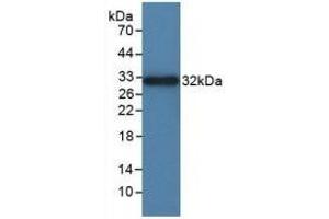 Detection of Recombinant ITGaD, Rat using Polyclonal Antibody to Integrin Alpha D (ITGaD) (ITGAD Antikörper  (AA 879-1099))