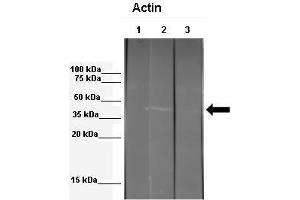 WB Suggested Anti-ACTB Antibody  Positive Control: Lane 1: 341 µg mouse 3T3 ECM extract + blocking peptide, Lane 2: 041 µg mouse 3T3 ECM extract, Lane 3: 041 µg Echinococcus granulosus extract Primary Antibody Dilution: 1:000Secondary Antibody: Anti-rabbit-HRP Secondry  Antibody Dilution: 1:00,000Submitted by: Anonymous (beta Actin Antikörper  (Middle Region))