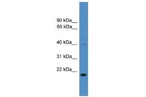 Western Blotting (WB) image for anti-TIMP Metallopeptidase Inhibitor 3 (TIMP3) (N-Term) antibody (ABIN2787970)