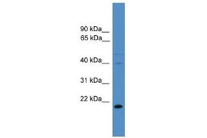 WB Suggested Anti-TIMP3 Antibody Titration: 0. (TIMP3 Antikörper  (N-Term))