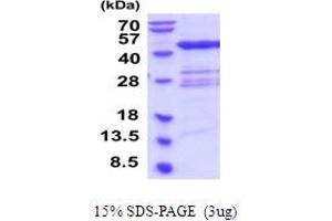 SDS-PAGE (SDS) image for Queuine tRNA-Ribosyltransferase 1 (QTRT1) (AA 1-403) protein (His tag) (ABIN6387595) (QTRT1 Protein (AA 1-403) (His tag))