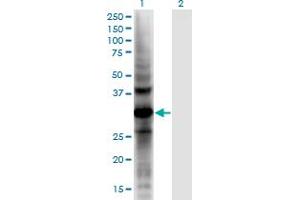 Western Blot analysis of AKR1CL2 expression in transfected 293T cell line by AKR1CL2 monoclonal antibody (M02), clone 1C8.