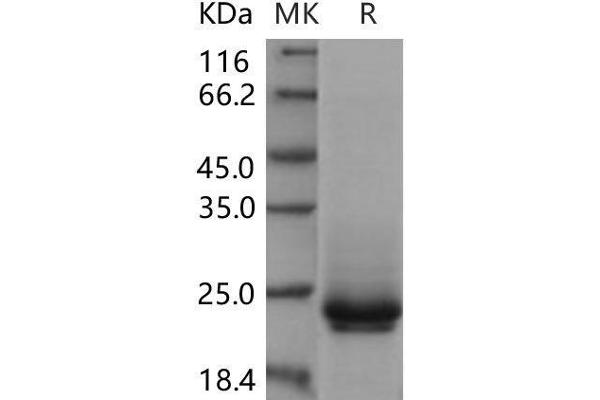 FZD10 Protein (His tag)