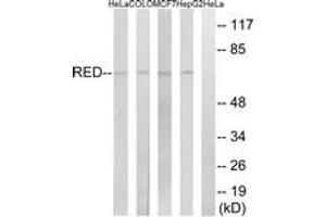 Western blot analysis of extracts from HepG2/MCF-7/COLO/HeLa cells, using RED Antibody. (DYRK3 Antikörper  (AA 508-557))