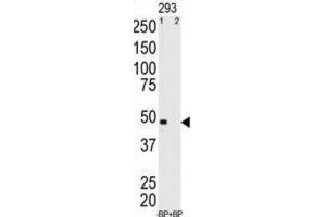 Western Blotting (WB) image for anti-Melanoma Antigen Family A, 11 (MAGEA11) antibody (ABIN3002529) (MAGEA11 Antikörper)