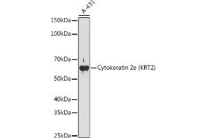 Keratin 2 抗体