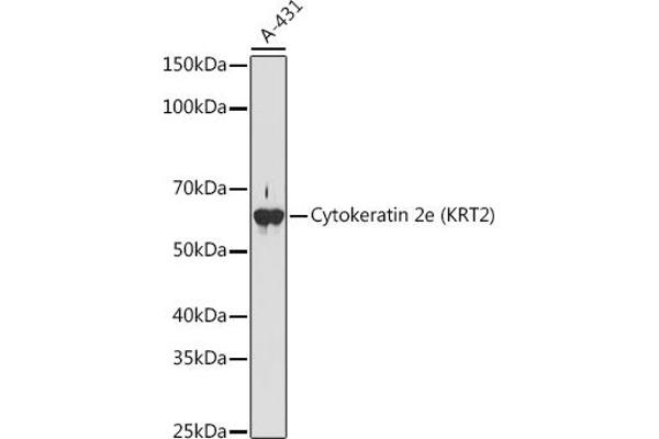Keratin 2 抗体