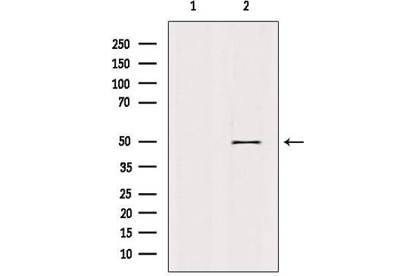 Retinoid X Receptor gamma Antikörper  (Internal Region)