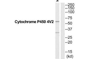 Western Blotting (WB) image for anti-Cytochrome P450, Family 4, Subfamily V, Polypeptide 2 (CYP4V2) (Internal Region) antibody (ABIN1852634) (CYP4V2 Antikörper  (Internal Region))