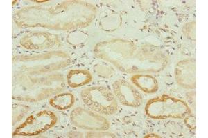 Immunohistochemistry of paraffin-embedded human kidney tissue using ABIN7173949 at dilution of 1:100 (TWIST2 Antikörper  (AA 1-70))