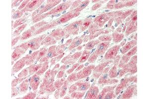 Immunohistochemistry (IHC) image for anti-Insulin-Like Growth Factor Binding Protein 2, 36kDa (IGFBP2) (AA 215-264) antibody (ABIN6755454)