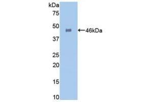Detection of Recombinant GLa, Human using Polyclonal Antibody to Galactosidase Alpha (GLa) (GLA Antikörper  (AA 81-429))