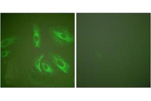 Immunofluorescence analysis of HeLa cells, using Gastrin antibody (ABIN5976408). (Gastrin Antikörper  (Internal Region))