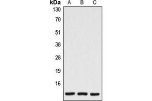 Western blot analysis of Caspase 7 p11 expression in HEK293T (A), mouse spleen (B), rat spleen (C) whole cell lysates. (Caspase 7 p11 (Center) Antikörper)